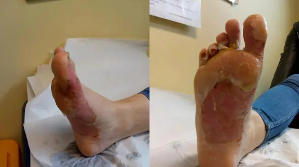 بلایی که سر دختر جوان در حال قدم زدن در ساحل داغ آمد + عکس