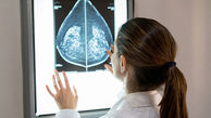 یک روش جدید برای درمان سرطان پستان