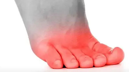سوزش انگشت پا از چیست؟ / درمان خانگی سوزش انگشت پا