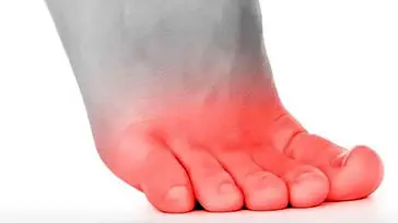 سوزش انگشت پا از چیست؟ / درمان خانگی سوزش انگشت پا