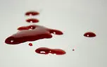 کشف جسد مرموز مردی در یافت آباد تهران! / خانه حمام خون بود
