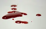 کشف جسد مرموز مردی در یافت آباد تهران! / خانه حمام خون بود