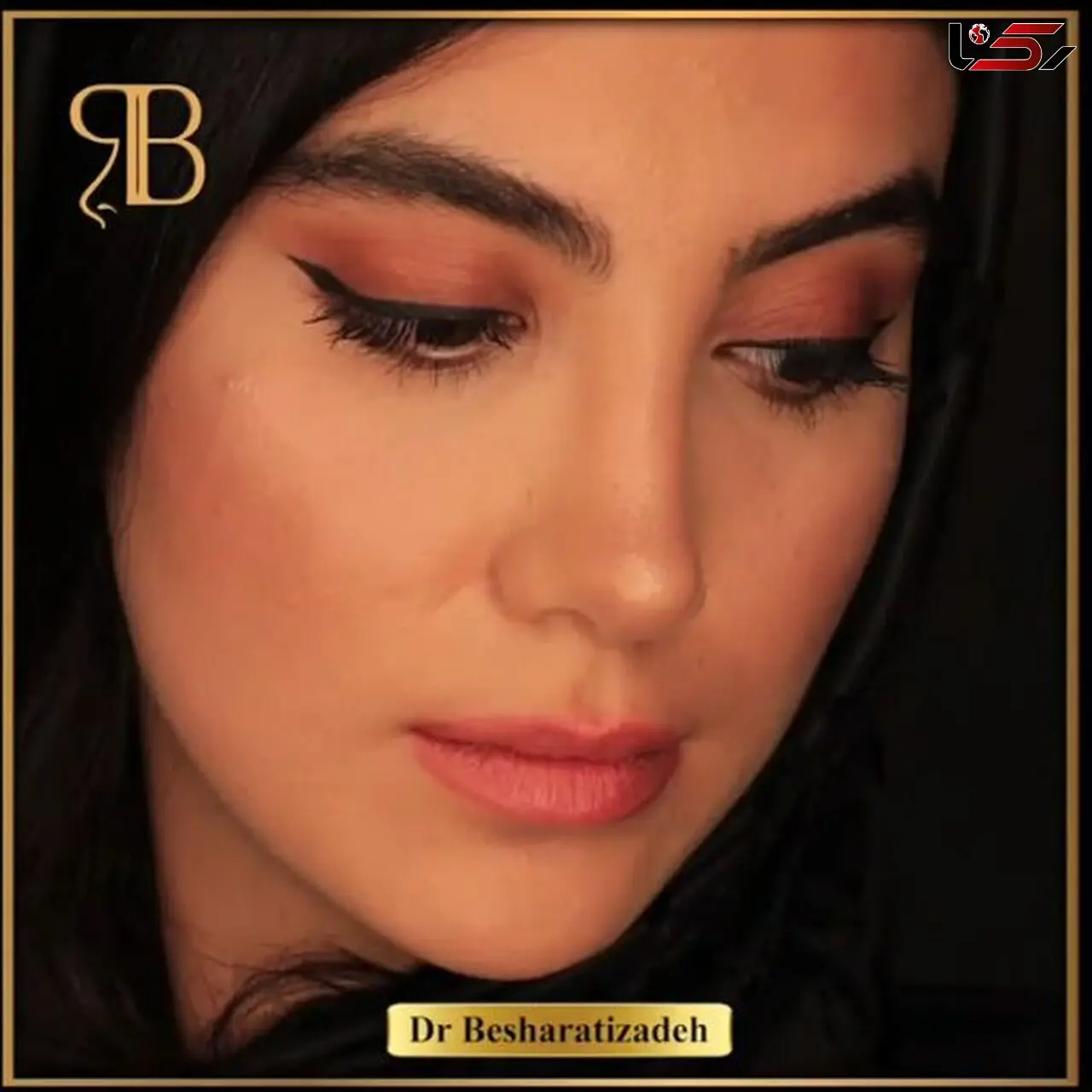 بهترین جراح بینی تهران
