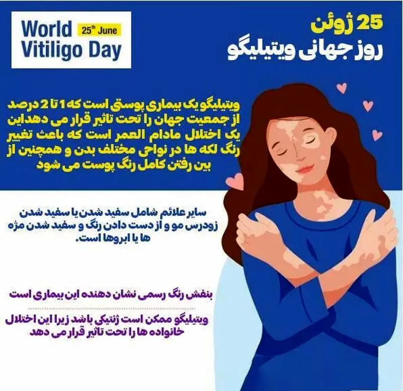 روز جهان لک و پیس