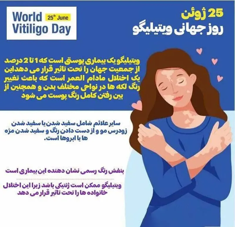 روز جهان لک و پیس