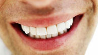 راز دندان‌های سالم چیست؟