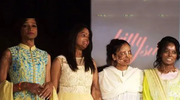 زنان اسید سوخته روی فرش قرمز + عکس تلخ