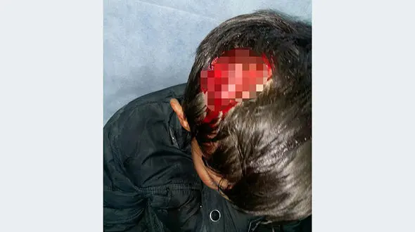 دست و پا زدن نوجوان سهندی زیر چنگال های سگ ولگرد+ عکس دلخراش