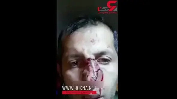 دردسر وحشتناک برای سگ‌باز + فیلم (16+)