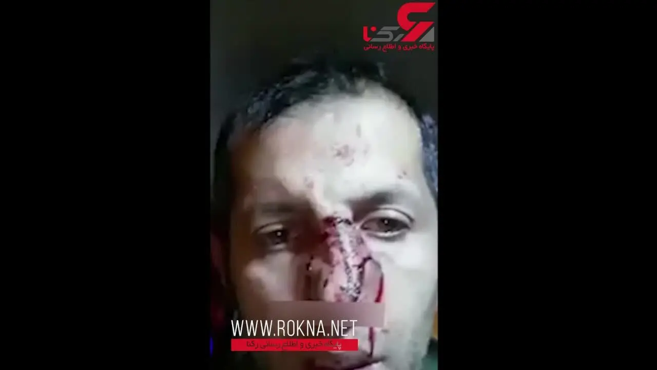 دردسر وحشتناک برای سگ‌باز + فیلم (16+)