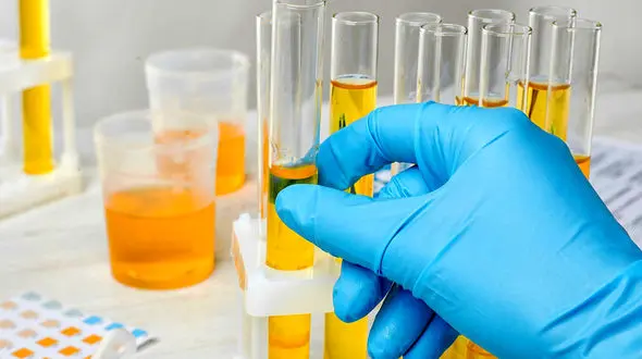 تغییر رنگ ادرار نشانه چیست؟