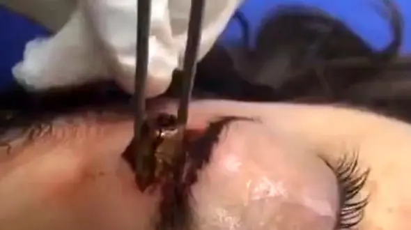 برخورد گلوله به صورت دختر 15 ساله +فیلم و عکس (+16)