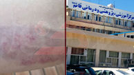 پزشک فوق تخصص مغز و اعصاب زن در  بیمارستان قائم مشهد پرستار را کتک زد! 