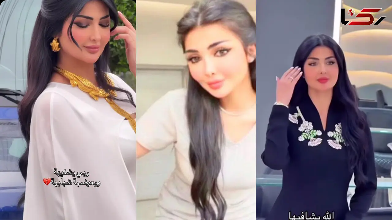 فیلم تلخ / اسیدپاشی به صورت زیبای فیروزه توسط شوهر سابقش/ 3 ماه پیش جدا شده بودند