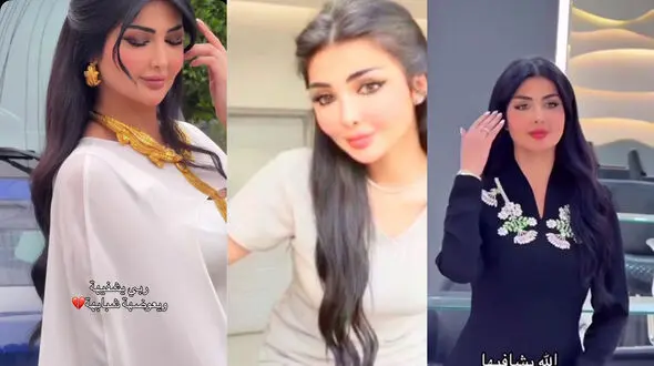 فیلم تلخ / اسیدپاشی به صورت زیبای فیروزه توسط شوهر سابقش/ 3 ماه پیش جدا شده بودند