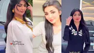 فیلم تلخ / اسیدپاشی به صورت زیبای فیروزه توسط شوهر سابقش/ 3 ماه پیش جدا شده بودند