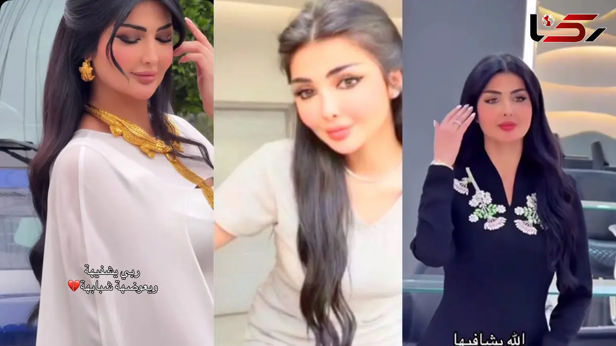 فیلم تلخ / اسیدپاشی به صورت زیبای فیروزه توسط شوهر سابقش/ 3 ماه پیش جدا شده بودند