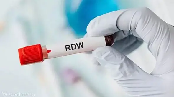 بالا بودن rdw-cv در آزمایش خون نشانه چیست؟