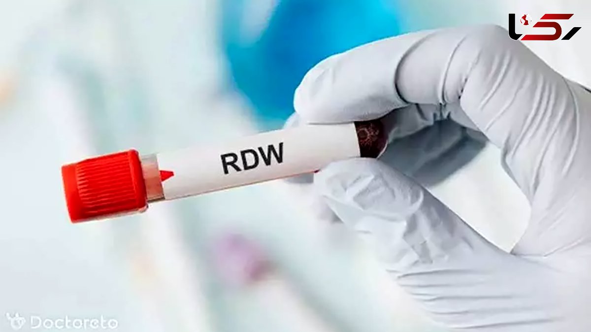 بالا بودن rdw-cv در آزمایش خون نشانه چیست؟