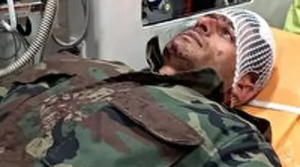 مجروحیت شدید 2 جنگلبان لنگرودی در درگیری با مردان بی رحم + عکس