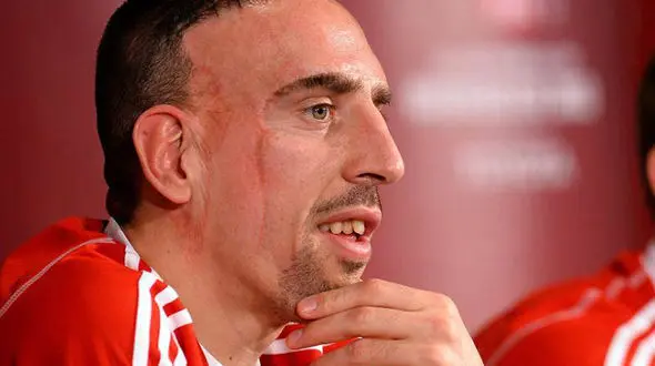 ناگفته‌های تلخ ریبری درباره زخم صورتش 