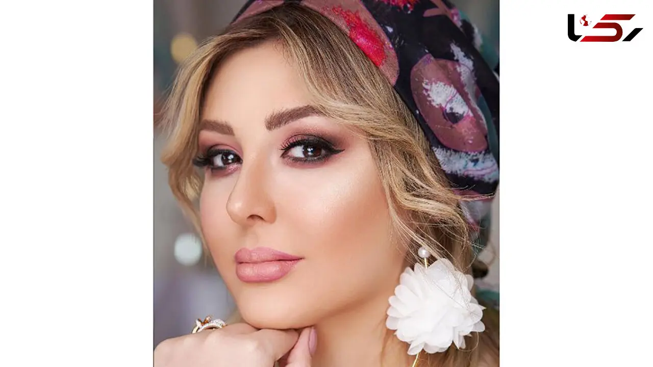 تاثیر عجیب دومین عمل بینی نیوشا ضیغمی در زیبایی اش ! + عکس ها