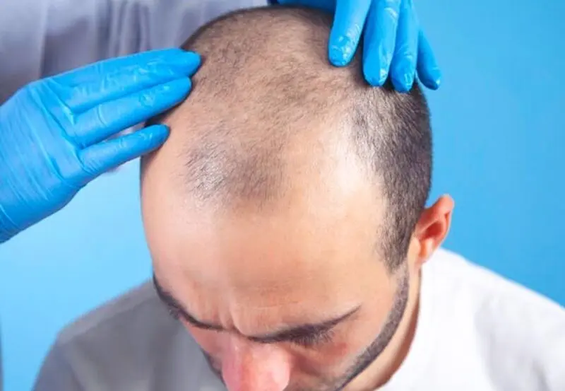 عوارض مراجعه به مراکز غیر حرفه‌ای چیست
