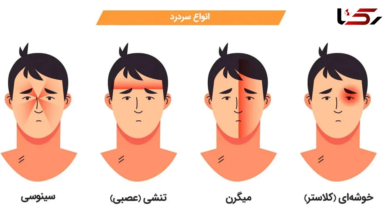 راهنمای جامع برای غلبه بر سردردهای عصبی