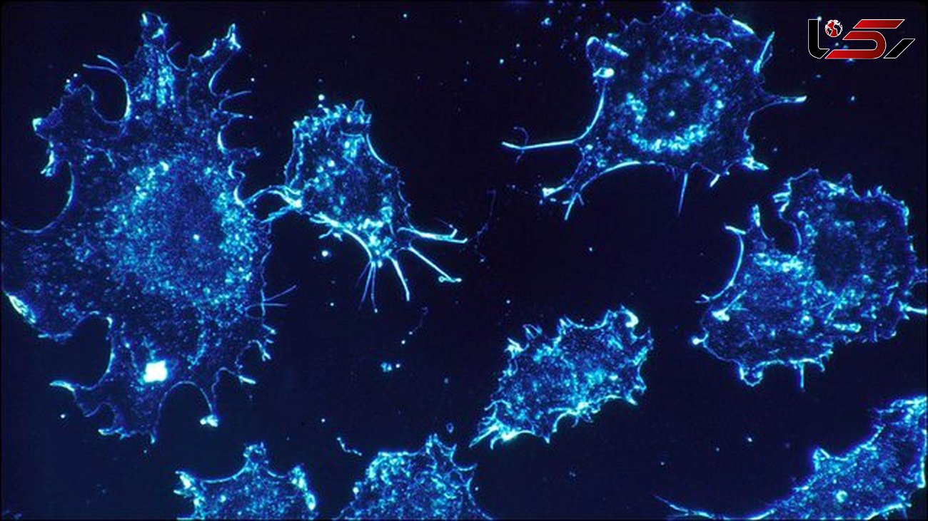 سلول های سرطانی برای افزایش رشد تومورها ساعت بیولوژیکی بدن را تغییر می دهند