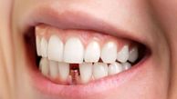 ایمپلنت دندان: نکات کلیدی و بایدها و نبایدها