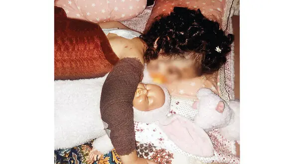  حمله خونین سگ‌های ولگرد به دختر 3 ساله و مادرش در کرج + عکس
