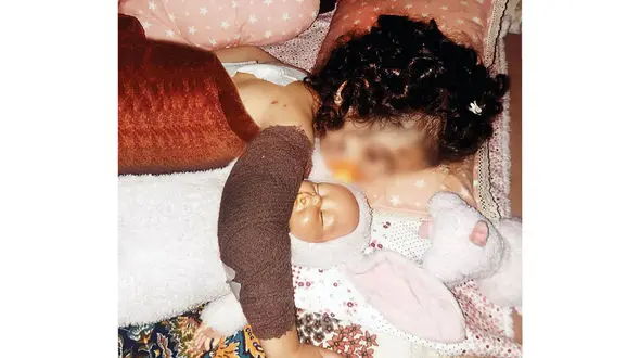  حمله خونین سگ‌های ولگرد به دختر 3 ساله و مادرش در کرج + عکس