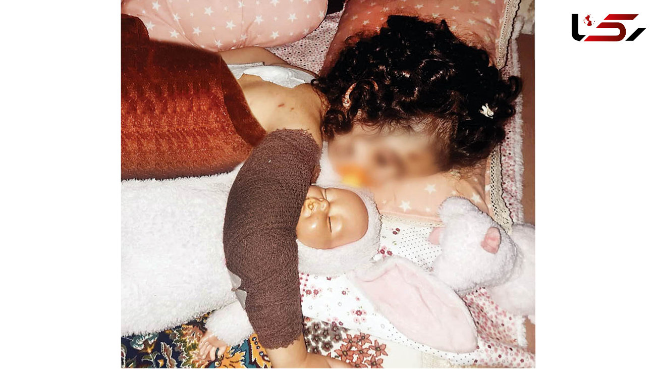  حمله خونین سگ‌های ولگرد به دختر 3 ساله و مادرش در کرج + عکس