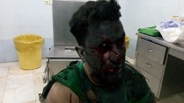 پسر ۱2 ساله تهرانی جانش را در شب چهارشنبه سوری داد+عکس