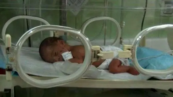 تولد نوزاد از مادر کرونایی بعد از 20 سال انتظار و نازایی + عکس