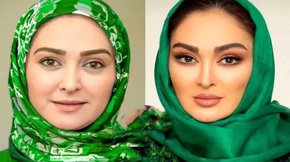 فیلم/ الهام حمیدی: من دوست ندارم فیلر بزنم.../ صورت طبیعی خودم را دوست دارم.../  فقط میخوام صورتمو...!