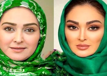 فیلم/ الهام حمیدی: من دوست ندارم فیلر بزنم.../ صورت طبیعی خودم را دوست دارم.../  فقط میخوام صورتمو...!