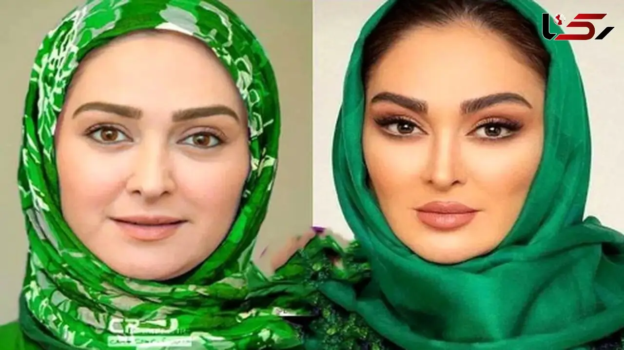 فیلم/ الهام حمیدی: من دوست ندارم فیلر بزنم.../ صورت طبیعی خودم را دوست دارم.../  فقط میخوام صورتمو...!