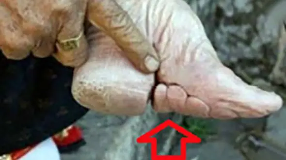 مرا به کشتن بده اما خوشگلم کن‌/ لب بشقابی و تغییر شکل جمجمه! + تصاویر