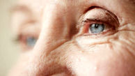  آرتریت روماتوئید چشمی افراد بالای 18 سال را تهدید می کند
