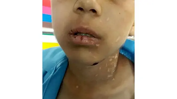 ناگفته های دایی دانیال کوچولو کودک سبزواری از کتک های پدر و نامادری + فیلم