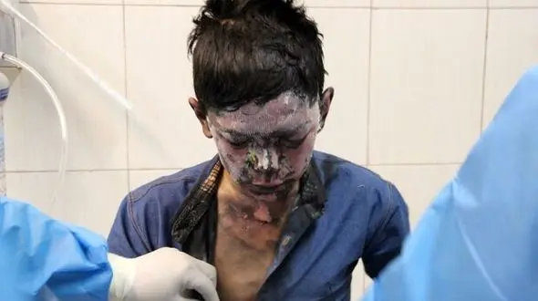  آخرین آمار مصدومان چهارشنبه‌سوری در تهران / 97 مصدوم و 7 فوتی