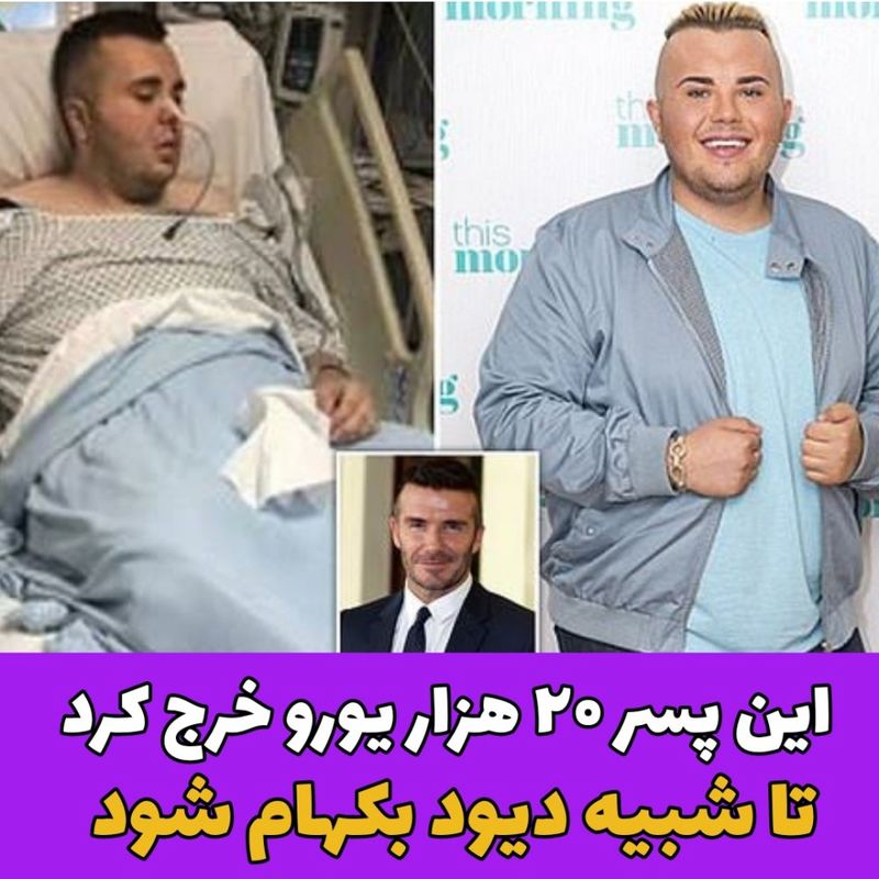 این پسر ۲۰ هزار یورو خرج کرد تا شبیه دیوید بکهام شود!