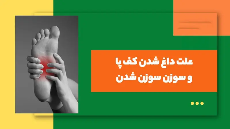 علت داغی کف پا