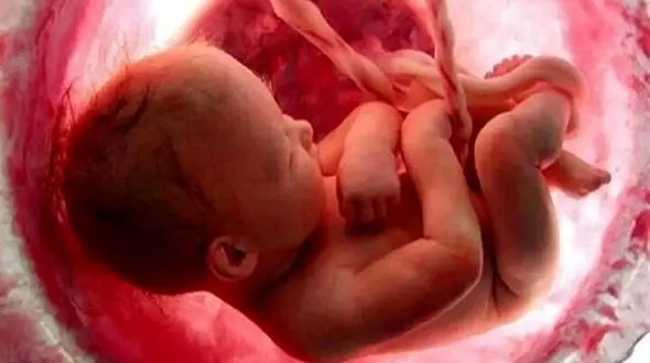 پاسخ دانشگاه علوم پزشکی ایران به شایعه گم شدن جنین‌ها در بیمارستان آبان