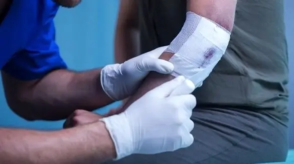 بهبود زخم های عمیق در 120 ثانیه/با پلاسمای سرد