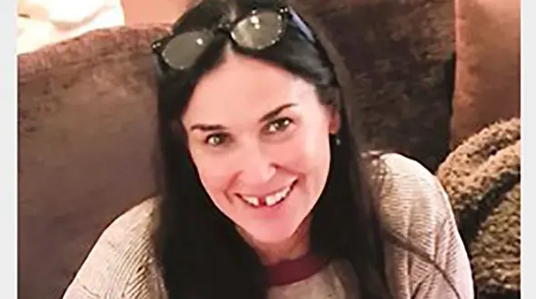 بزرگترین قاتل در امریکا دندان های هنرپیشه معروف را انداخت+عکس