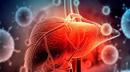 آیا سرطان کبد به قاتل 1/5 میلیون نفر تا سال 2050 تبدیل می‌ شود؟