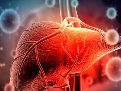 آیا سرطان کبد به قاتل 1/5 میلیون نفر تا سال 2050 تبدیل می‌ شود؟
