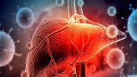 آیا سرطان کبد به قاتل 1/5 میلیون نفر تا سال 2050 تبدیل می‌ شود؟